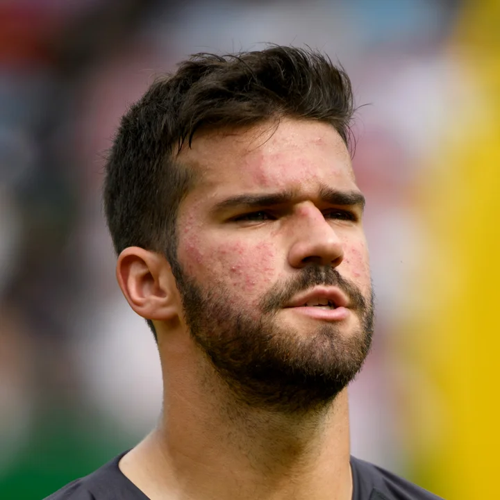 Alisson